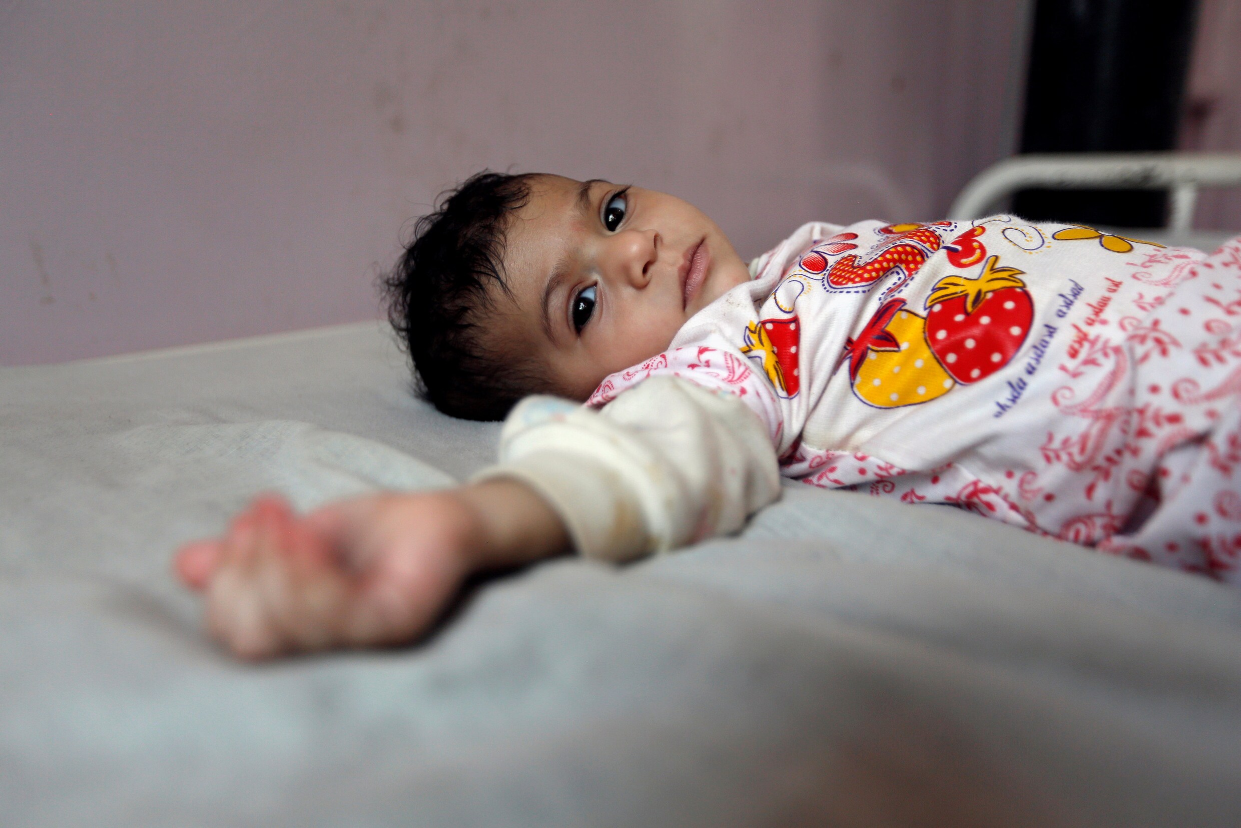 Jemen op rand van hongersnood: twee miljoen kinderen lijden aan acute ondervoeding