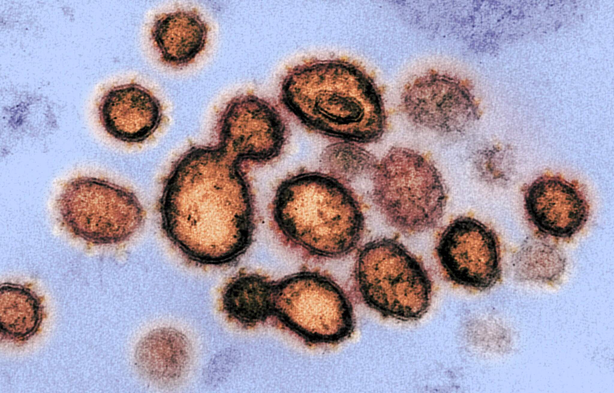 Viroloog: ‘Agressieve virussen waaraan mensen snel doodgaan, sterven snel uit’