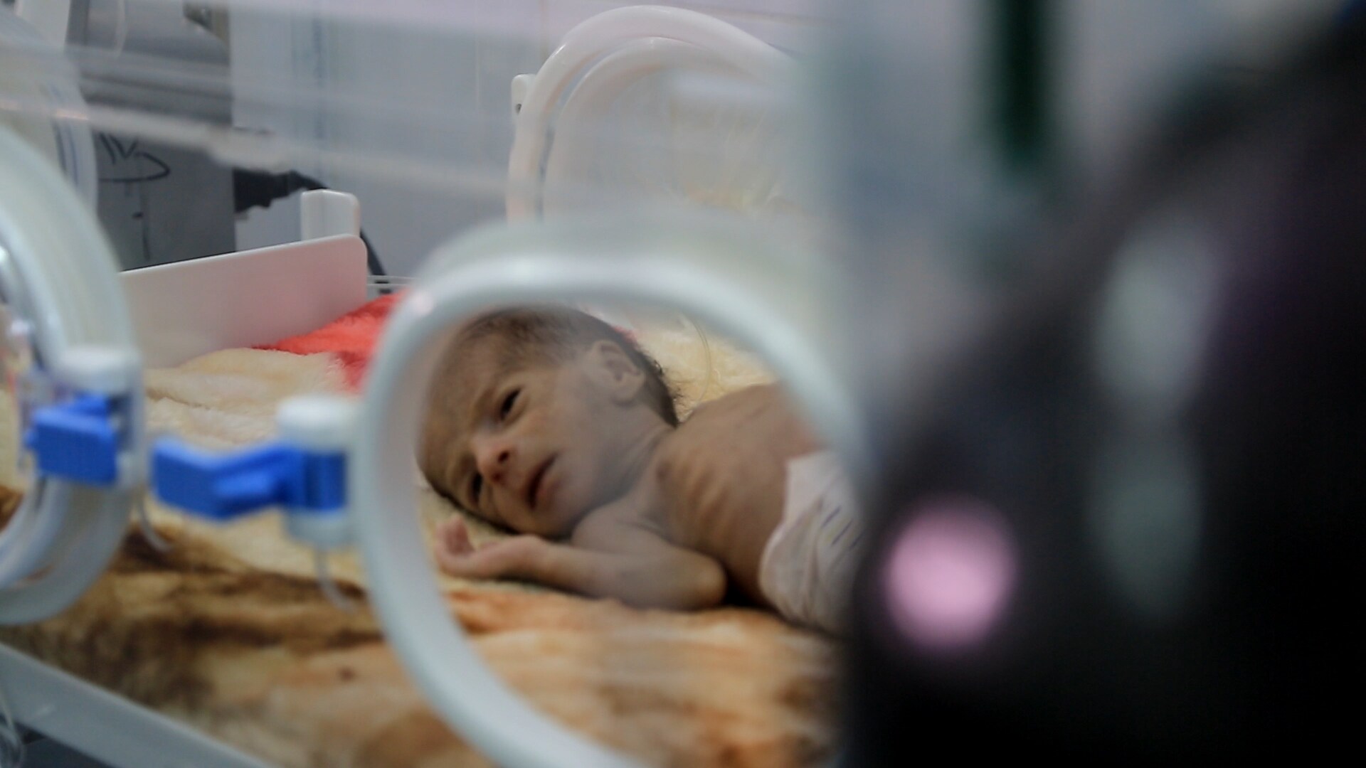 ik-ben-bang-dat-onze-nieuwe-baby-ook-misvormd-is-de-onzichtbare