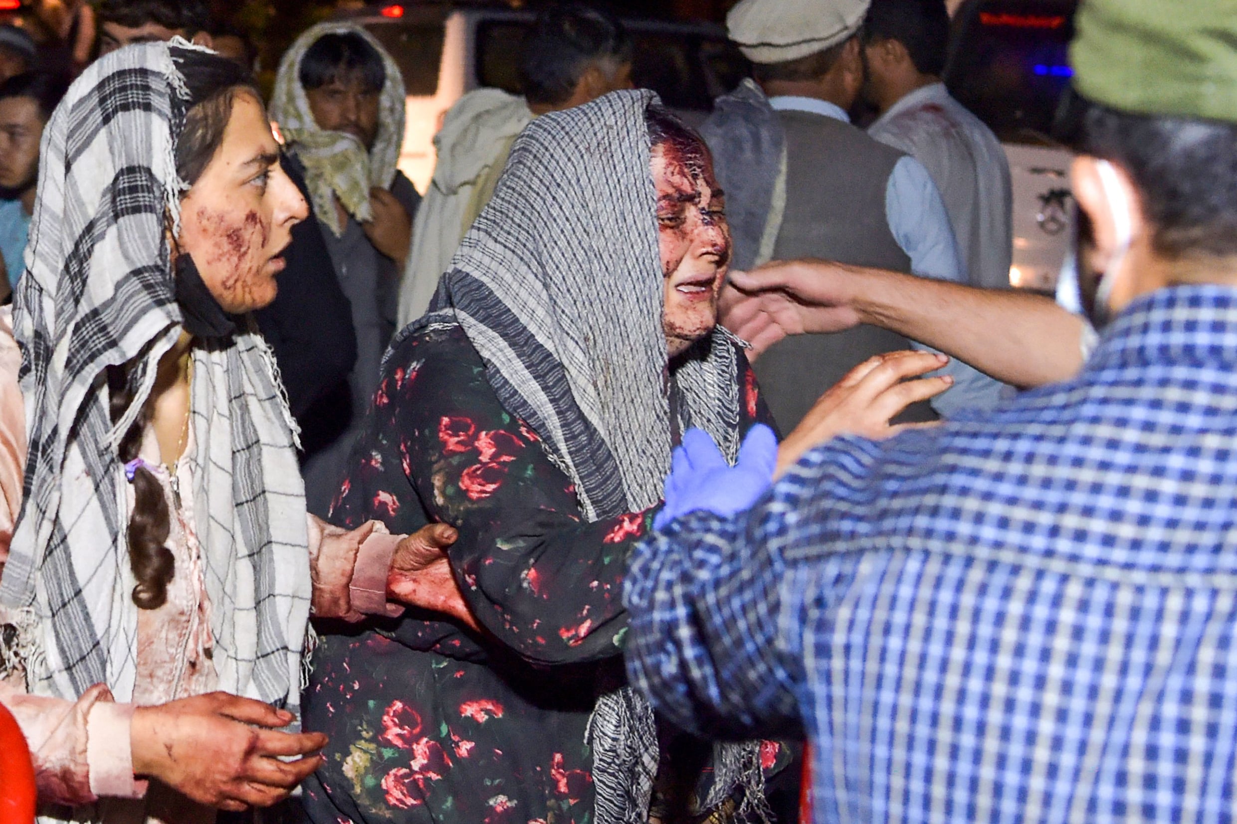 Al zeker 85 doden en 160 gewonden na aanslag Kaboel: dit is alles wat we nu weten