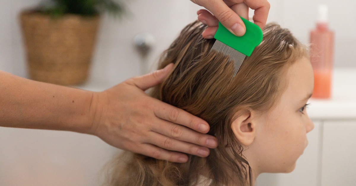 Hoe Kom Je Zo Snel Mogelijk Van Hoofdluizen Af Shampoos Lijken Niet Beter Te Helpen Dan Kammen