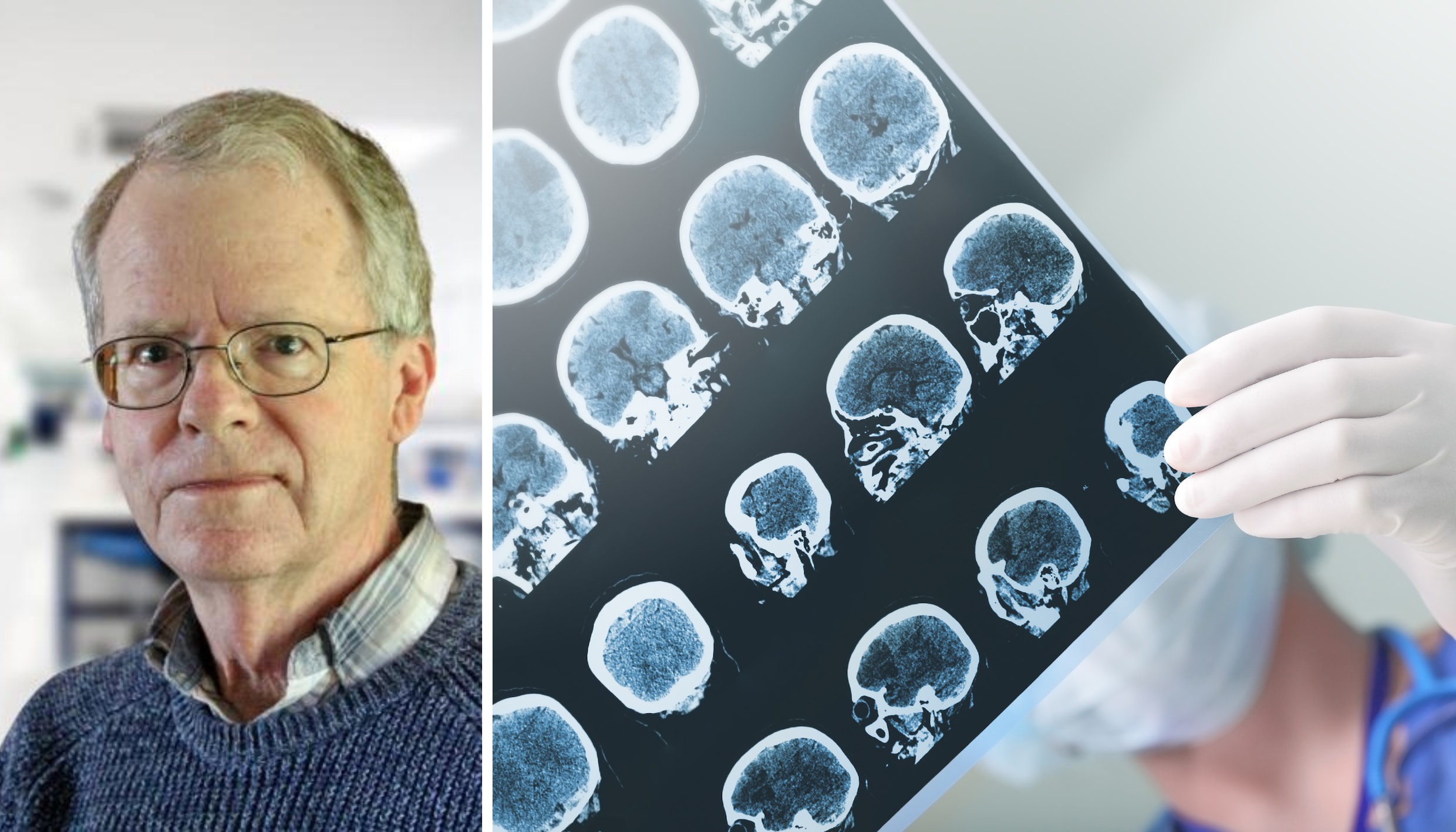 Deze neuroloog kreeg zelf alzheimer. Er is volgens hem wel iets te doen aan de ziekte ‘Met deze