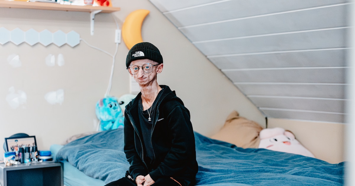 Progeriapatiënt Michiel Vandeweert gestorven op 28-jarige leeftijd: 'Hij  inspireerde velen door voluit te leven' | De Morgen