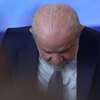 Braziliaanse president Lula start preventieve radiotherapie na operatie voor huidkanker