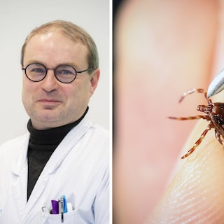 Tintelingen in de mond en de slokdarm en jeukende huiduitslag: steeds meer mensen krijgen vleesallergie. Hoe kan dat?