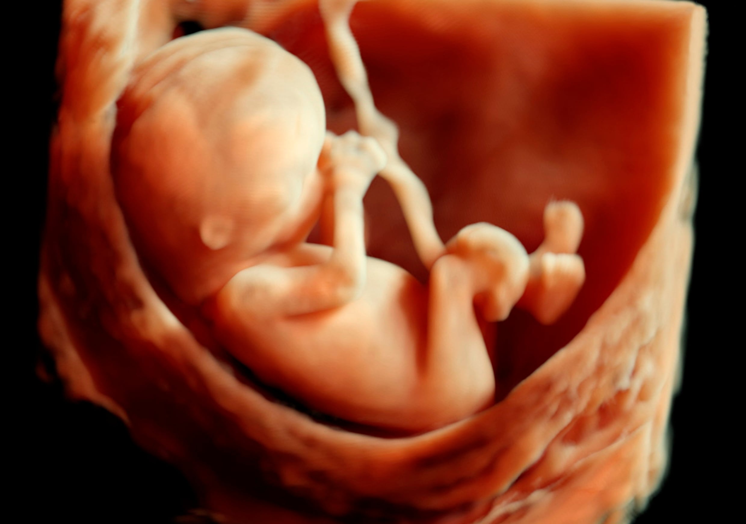 Onderzoek UHasselt bewijst: ‘Luchtvervuiling dringt door tot in de baarmoeder’