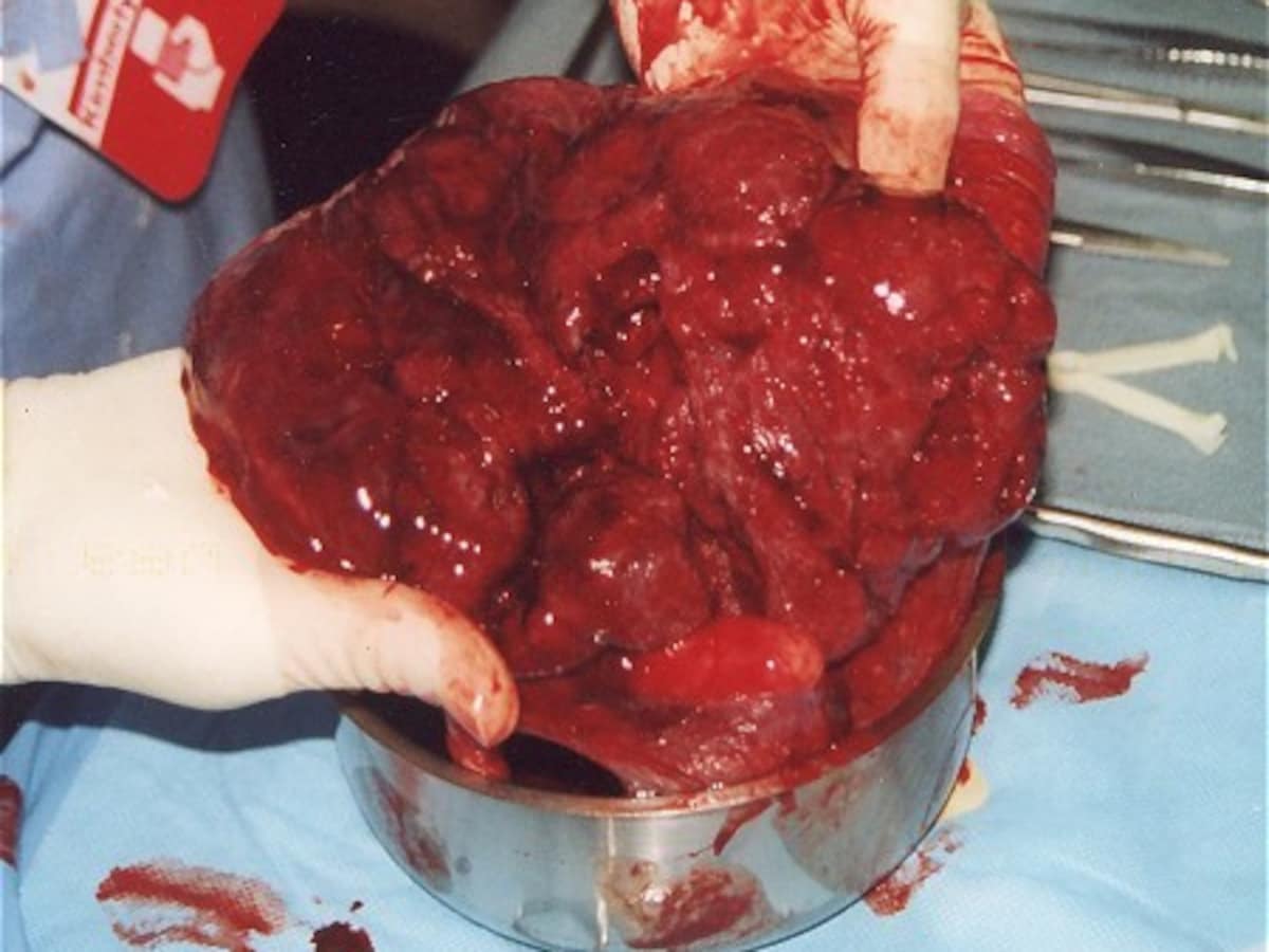 placenta verkopen