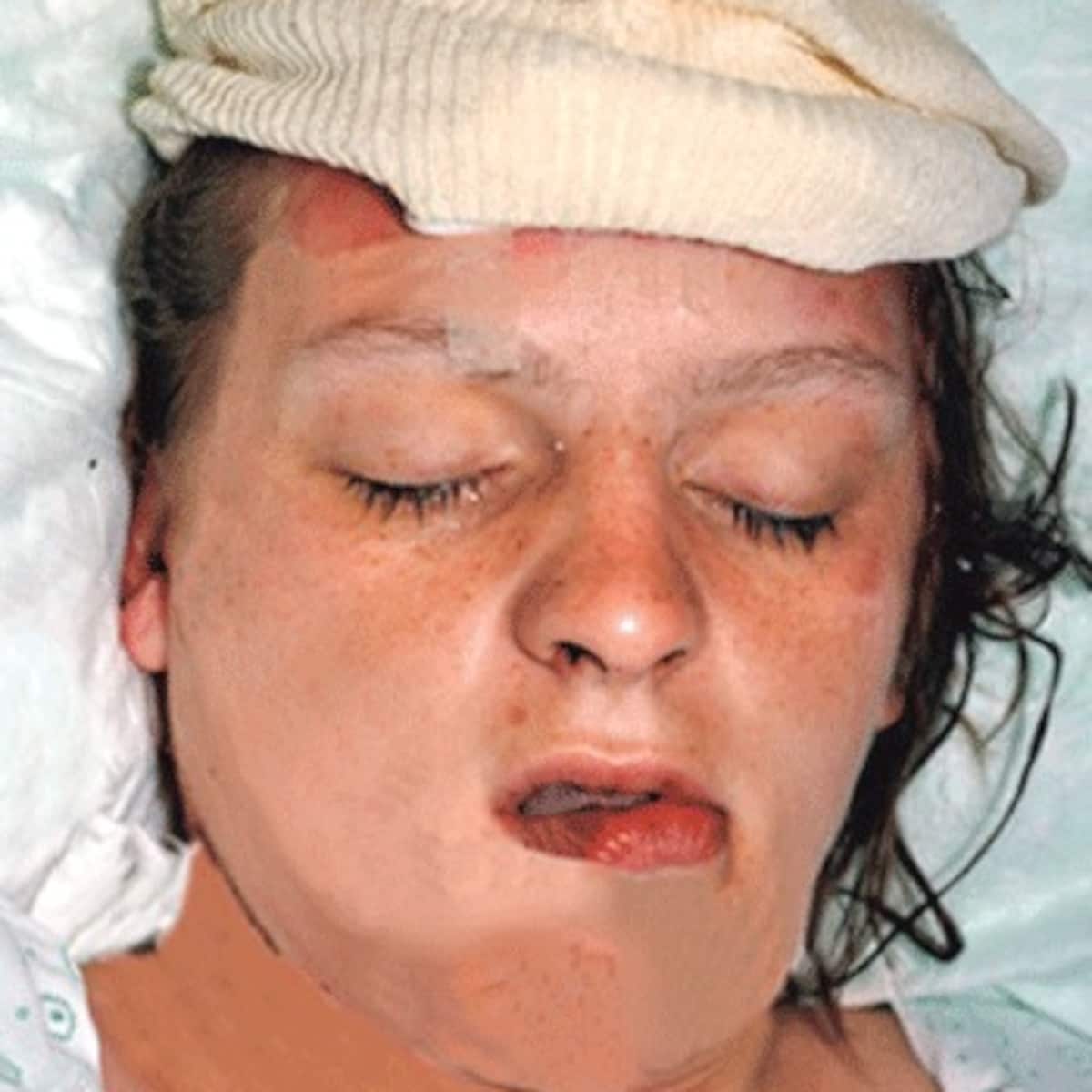 Aangereden zwangere vrouw uit Landen nog steeds in coma | De Morgen