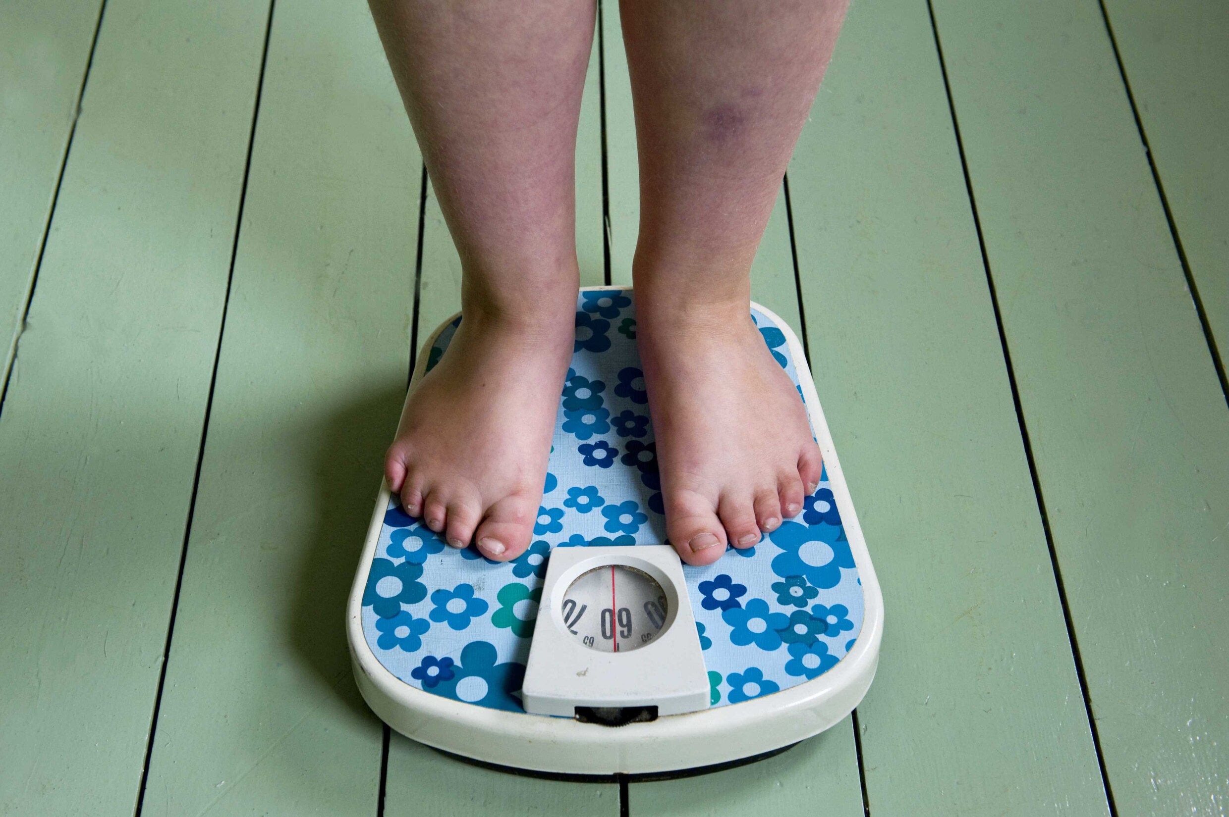 Ongezonde levensstijl allerjongsten baart zorgen: "Kinderen met obesitas sterven vroege dood"